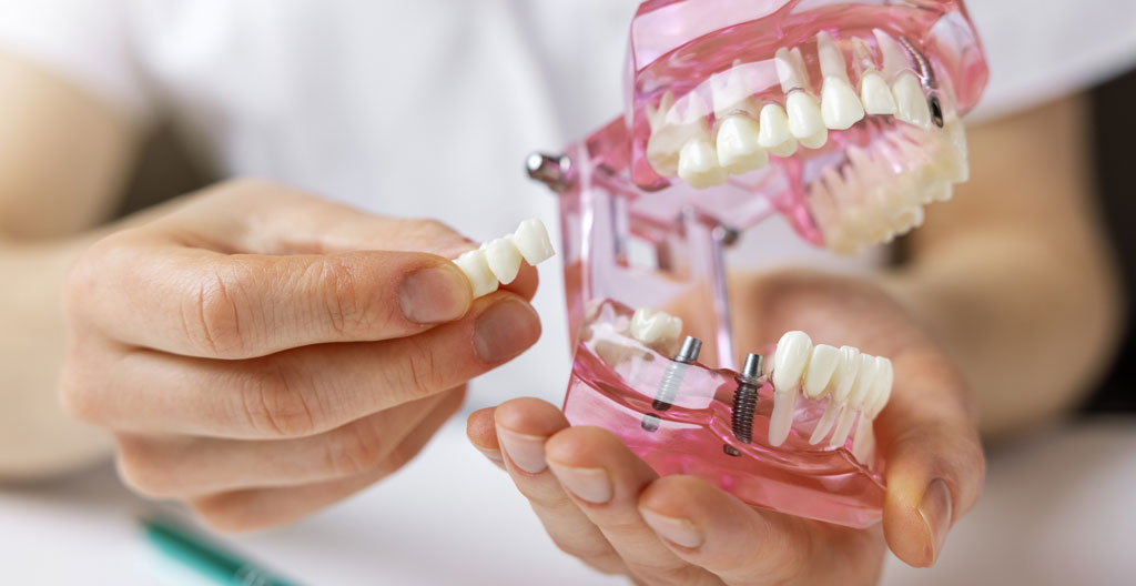 Consultation pré-implantaire dans un cabinet dentaire moderne avec praticien et patient examinant ensemble une planification 3D sur écran d'ordinateur dans un décor scandinave épuré